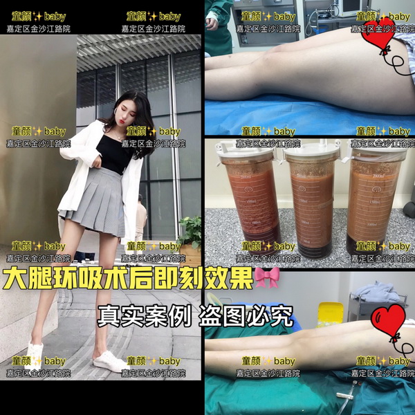 上海专业网红整形|上海童颜baby整形