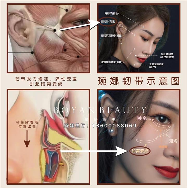 印第安纹韧带