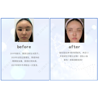 上海哪里可以取生长因子