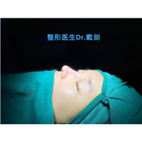 戴剑鼻整形案例