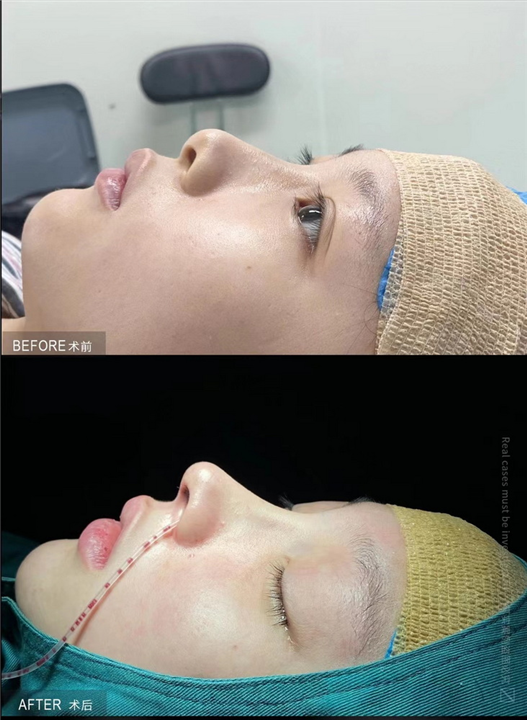 广州飞悦整形医院电话