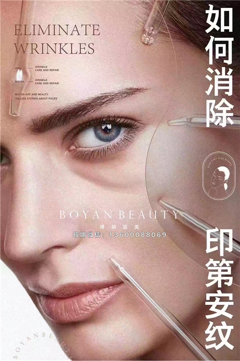 成都印第安纹剥离