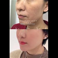 印第安纹怎么产生的