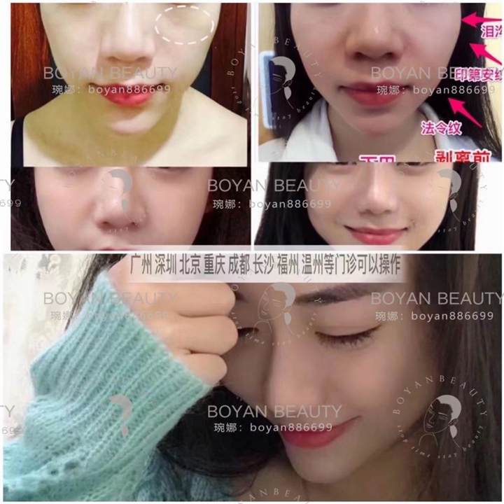 普宁博妍医美