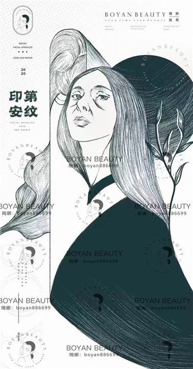 印第安纹剥离