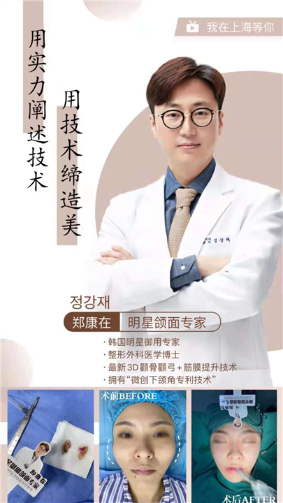 郑康在轮廓塑造,自然小V脸