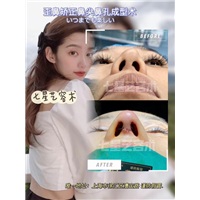 什么做鼻综合整形价格都不一样