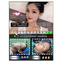 上海EOE整形|上海EOE整形医院