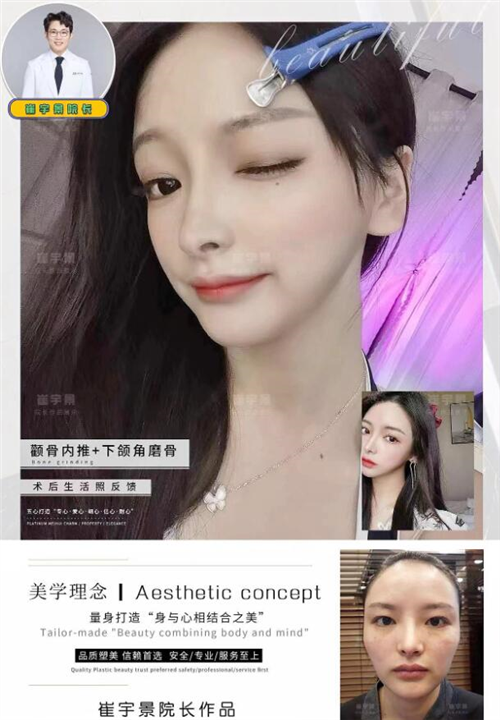 崔宇景磨骨