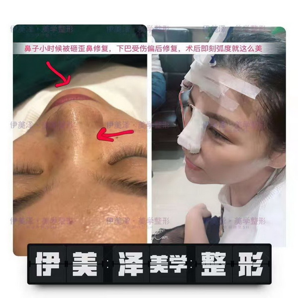 河南伊美泽修复医院