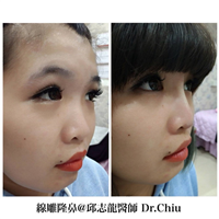 台湾整形专家