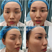 台湾**微整医生