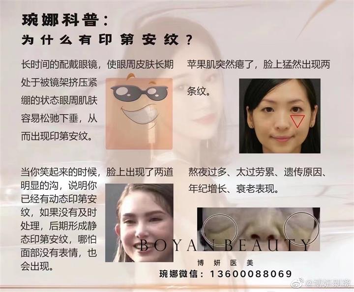印第安纹出现的原因原因