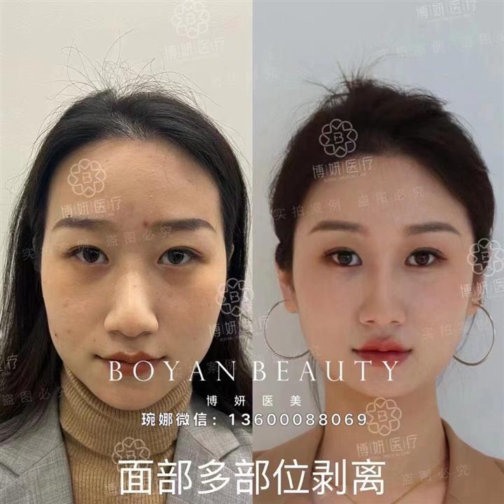 博妍剥离招牌印第安纹