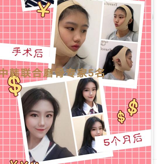 朴光哲医生怎么样