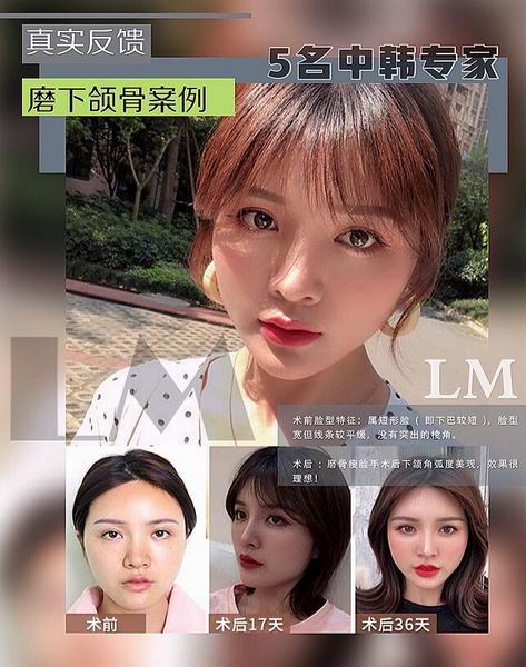 朴光哲医生怎么样