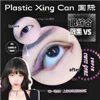 奢悦眼综合**案例 