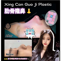 星璨国际肋骨隆鼻多少钱 