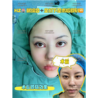 沪上眼综合整形