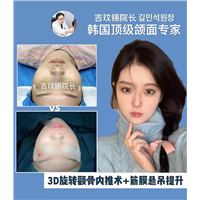 3D旋转颧骨内推术筋膜悬吊提