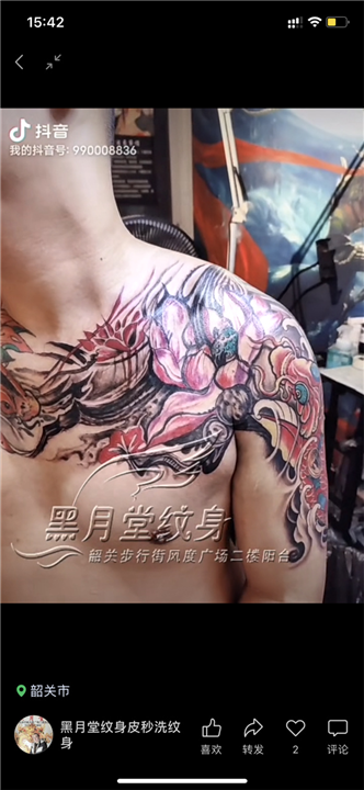 韶关佛山遮盖疤痕剖腹产纹身遮盖疤痕