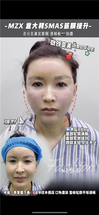 金晓东整形医生