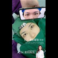 眼综合整形对比照