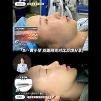 双面网兜对比图