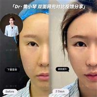 双面网兜