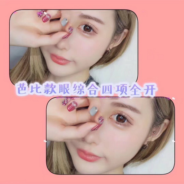 湖南眼综合双眼皮修复医生 