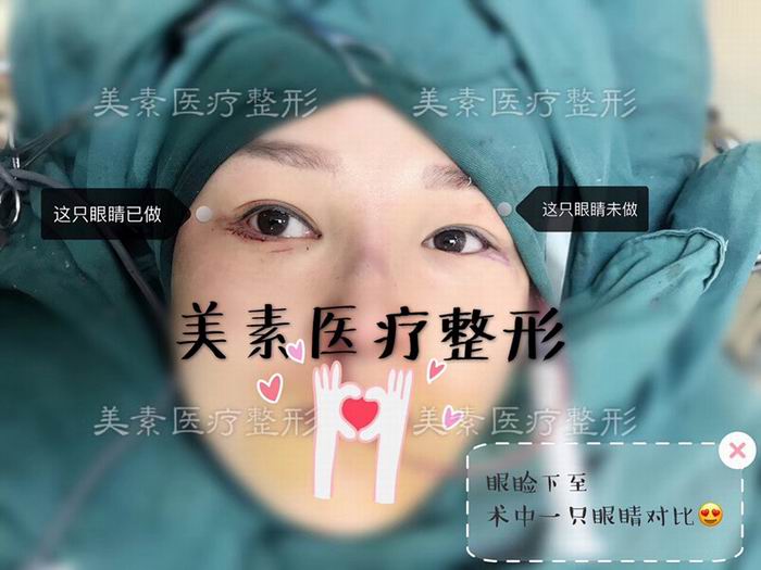 郑州美素整形医院→郑州整形医院哪家好 