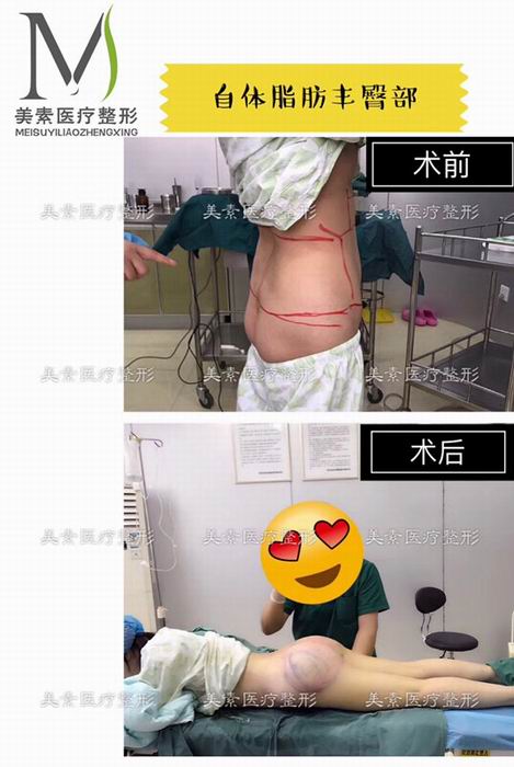 前后对比 