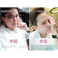 河南整形医院哪家好 