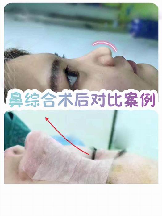 乐山微整形@乐山网红整形医院