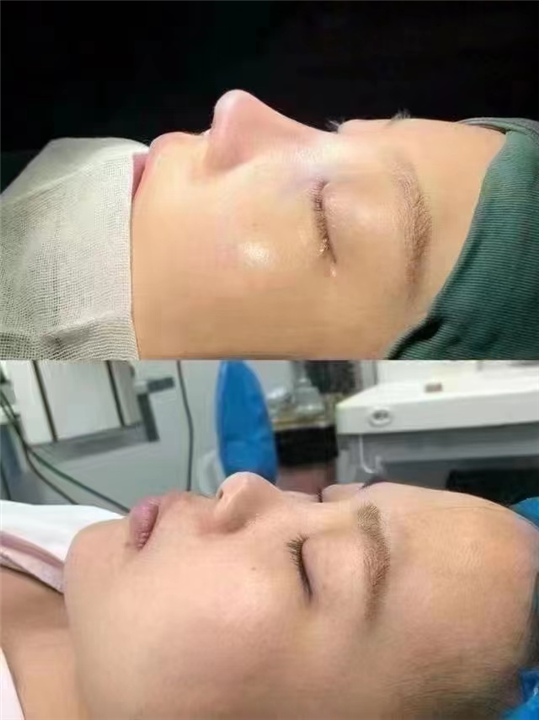 上海微加鼻综合整形