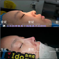 郑州曾斌
