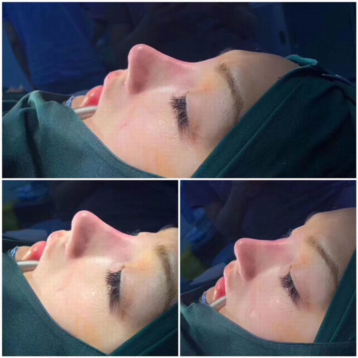 上海鼻综合整形医生