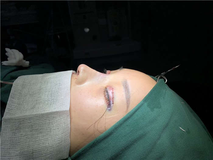 上海鼻综合整形医生