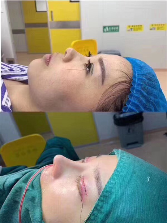 上海鼻综合整形医生