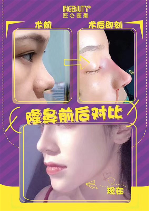 女神时代鼻整形王武松院长