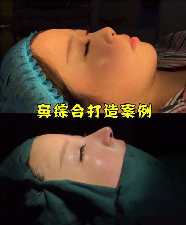 上海女神时代整形王武松鼻整形