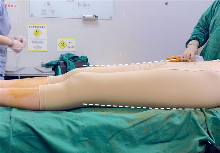 上海抽脂整形哪家好