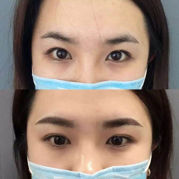 深圳纹眉哪家好 
