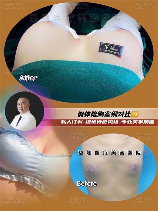 上海圣娅整形医院