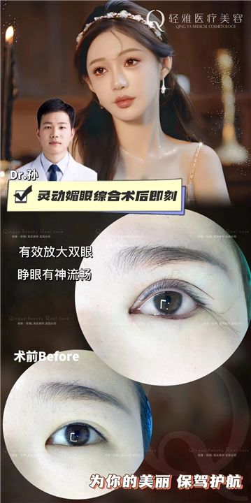 轻雅眼综合整形