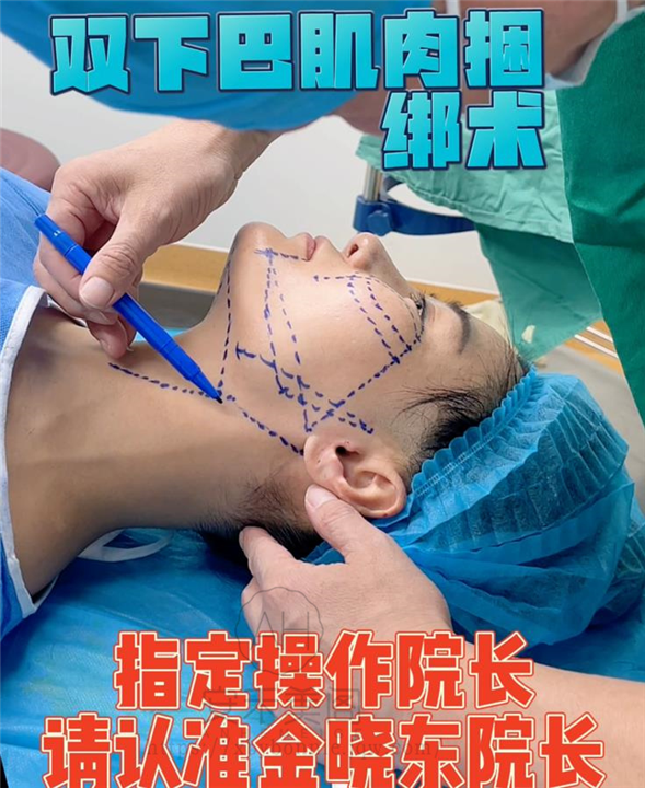 割双眼皮后可以维持一辈子吗