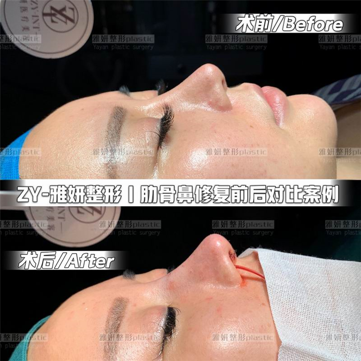 广州雅妍医疗整形 
