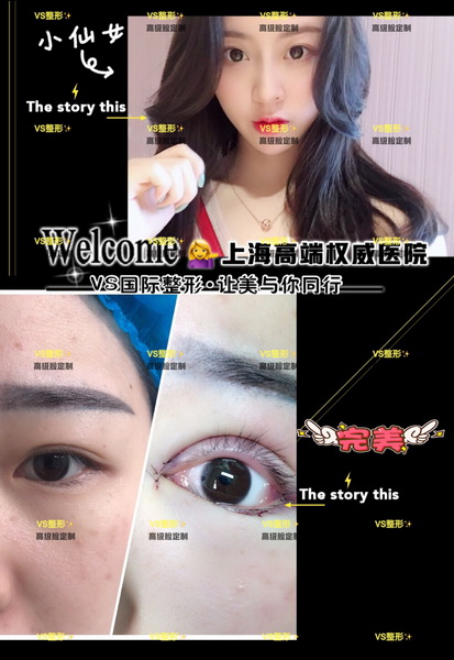 上海VS国际|上海VS整形