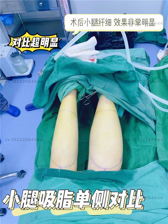 天津好的整形医生
