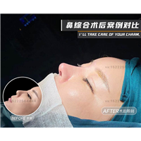 任静医生怎么样